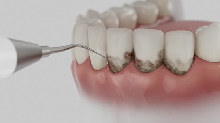 Trusted Teeth Whitening service in Dalhart, TX - Dentist Open Now